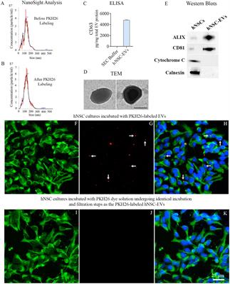 Intranasally administered extracellular vesicles from human induced pluripotent stem cell-derived neural stem cells quickly incorporate into neurons and microglia in 5xFAD mice